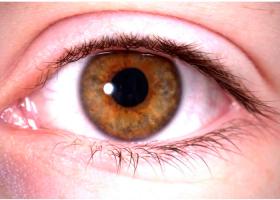 Imagen de Conjuntivitis 